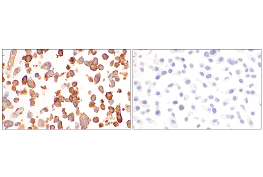 Immunohistochemistry Image 12: CRP2 (E8R5N) Rabbit Monoclonal Antibody