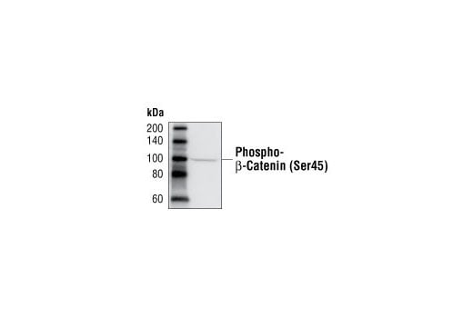 Western Blotting Image 3: Phospho-beta-Catenin (Ser45) Antibody