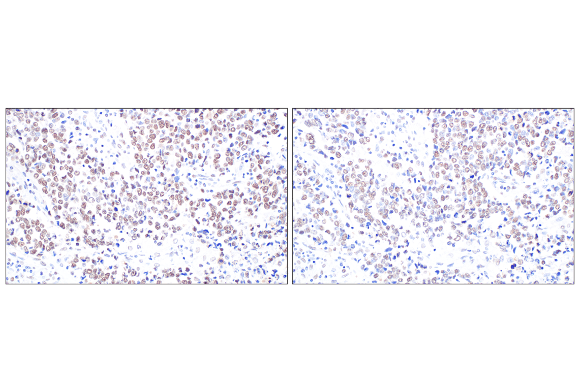 Immunohistochemistry Image 8: HDAC2 (3F3) Mouse Monoclonal Antibody