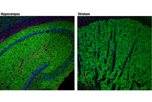 Immunofluorescence Image 1: mGluR5 (D6E7B) Rabbit Monoclonal Antibody