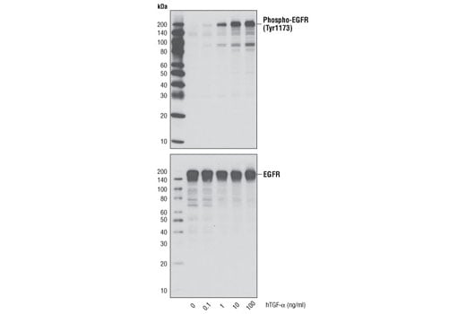 undefined Image 3: Human Transforming Growth Factor alpha (hTGF-alpha)