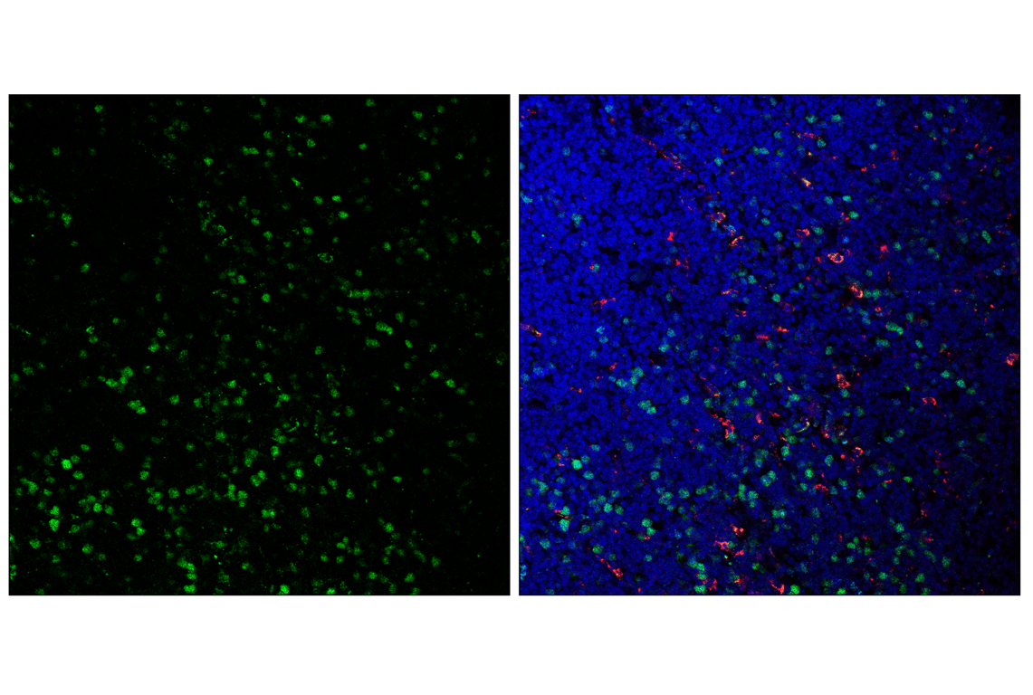 Immunofluorescence Image 1: Cyclin A2 (E9Q5G) Rabbit mAb (BSA and Azide Free)
