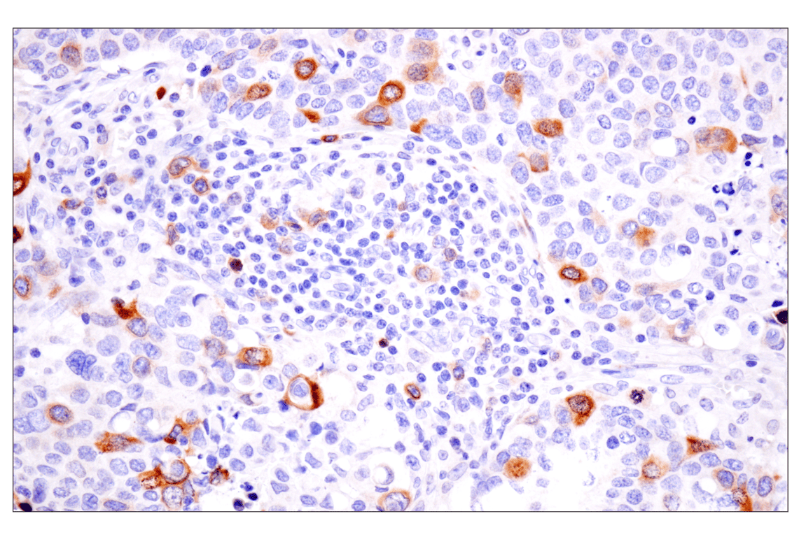 Immunohistochemistry Image 2: Cyclin B1 (F7U1O) Rabbit Monoclonal Antibody