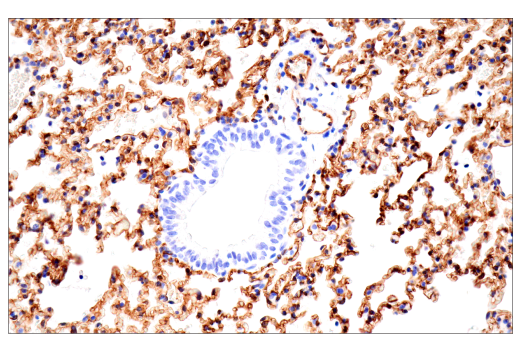 Immunohistochemistry Image 8: CD38 (E9F5A) Rabbit Monoclonal Antibody (BSA and Azide Free)