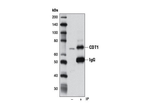 Immunoprecipitation Image 1: CDT1 (D10F11) Rabbit Monoclonal Antibody