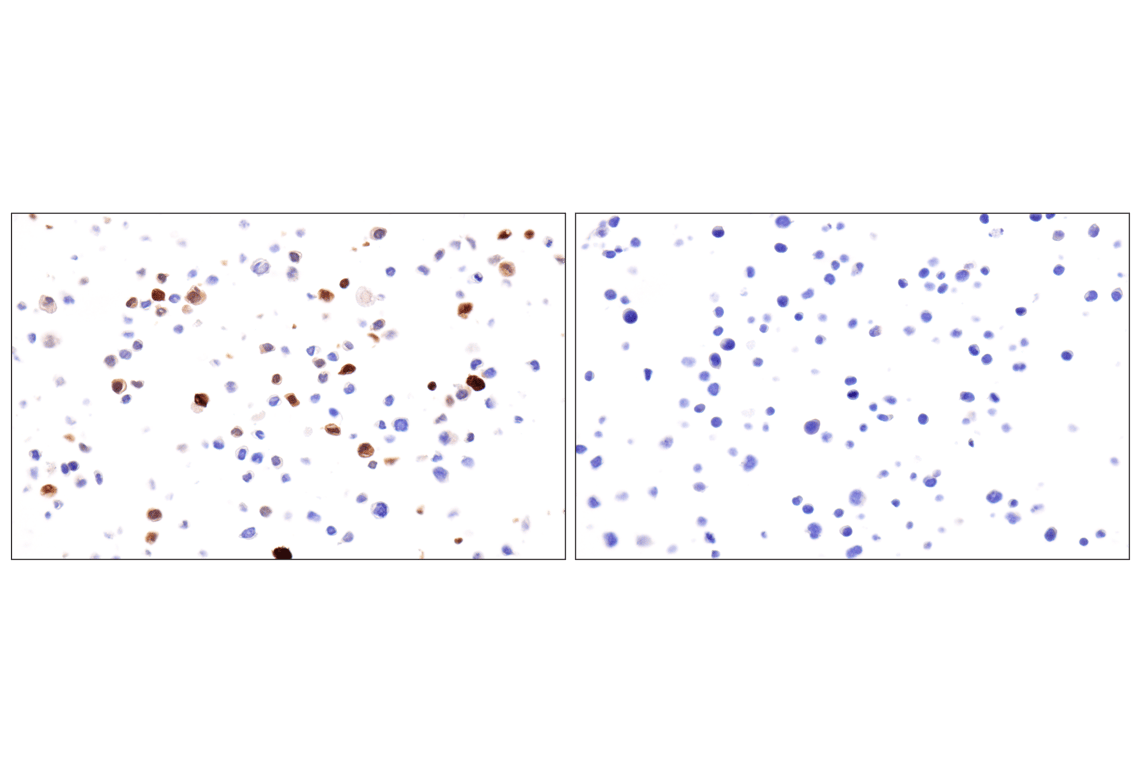 Immunohistochemistry Image 12: S100A8 (F4R2W) Rabbit Monoclonal Antibody