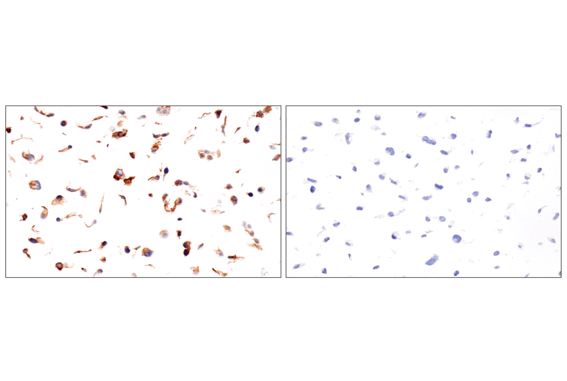 Immunohistochemistry Image 7: Folate Receptor Alpha/FOLR1 (BN3.2) Mouse Monoclonal Antibody