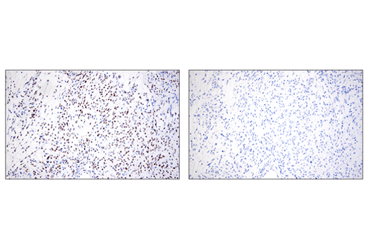はく。ページ　Sinai ZEB1 (E2G6Y) XP® Rabbit mAb (#70512) Datasheet With Images