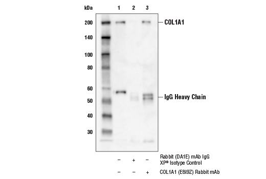 Immunoprecipitation Image 1: COL1A1 (E8I9Z) Rabbit Monoclonal Antibody