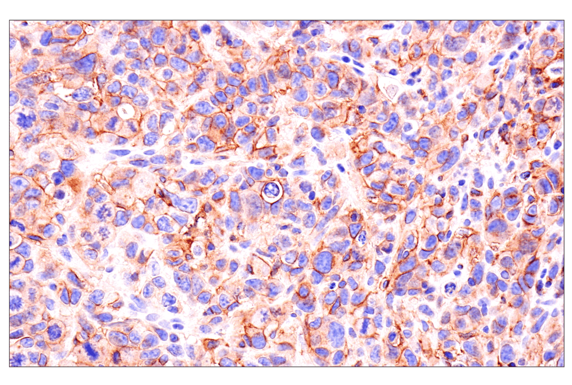 Immunohistochemistry Image 2: Axl (E3Z2H) Rabbit Monoclonal Antibody (BSA and Azide Free)