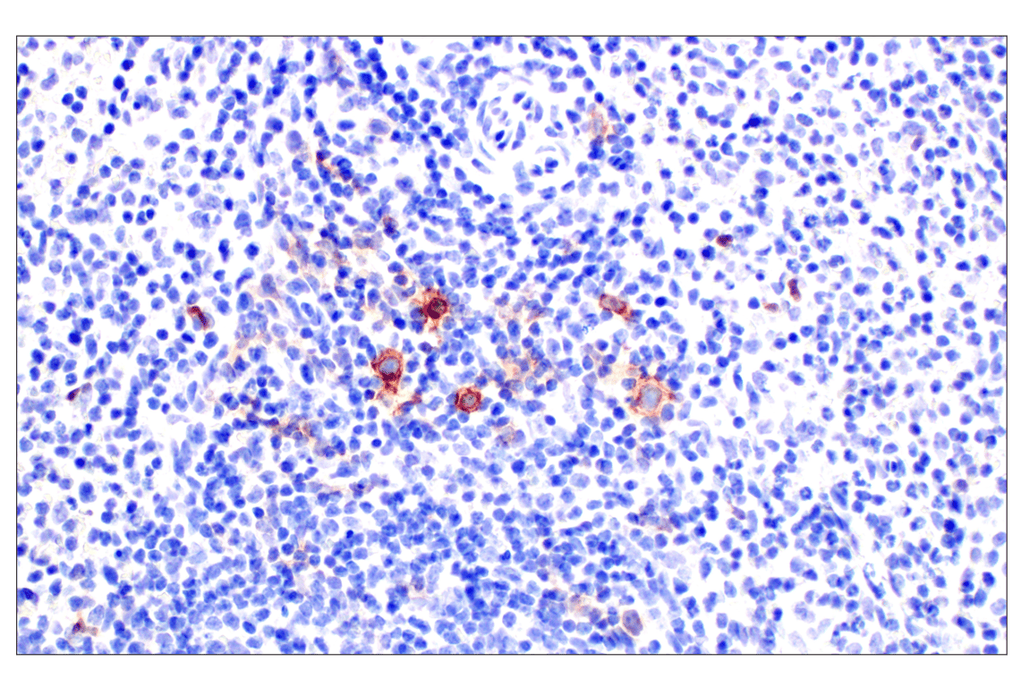Immunohistochemistry Image 5: TNFRSF8/CD30 (E4L4I) Rabbit Monoclonal Antibody