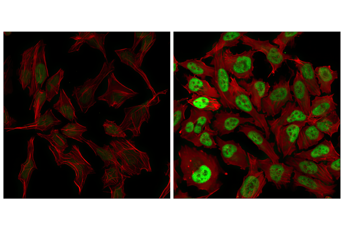 Immunofluorescence Image 1: c-Fos (9F6) Rabbit mAb