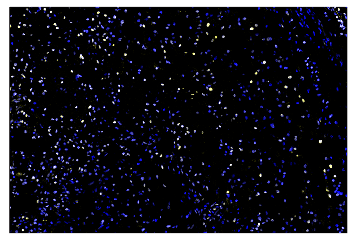 Immunohistochemistry Image 1: HIF-1 alpha (E1V6A) & CO-0117-488 SignalStar<sup>™</sup> Oligo-Antibody Pair