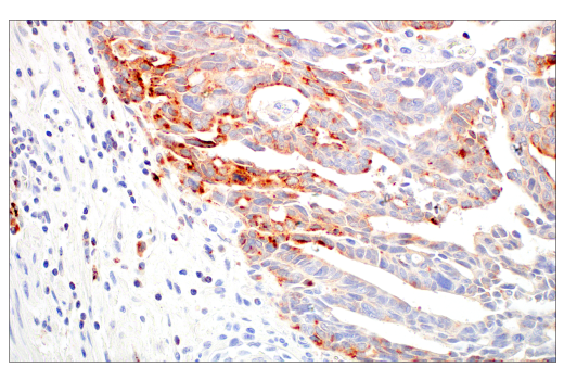 Immunohistochemistry Image 3: LAMP3/CD208 (E6E5U) Rabbit Monoclonal Antibody