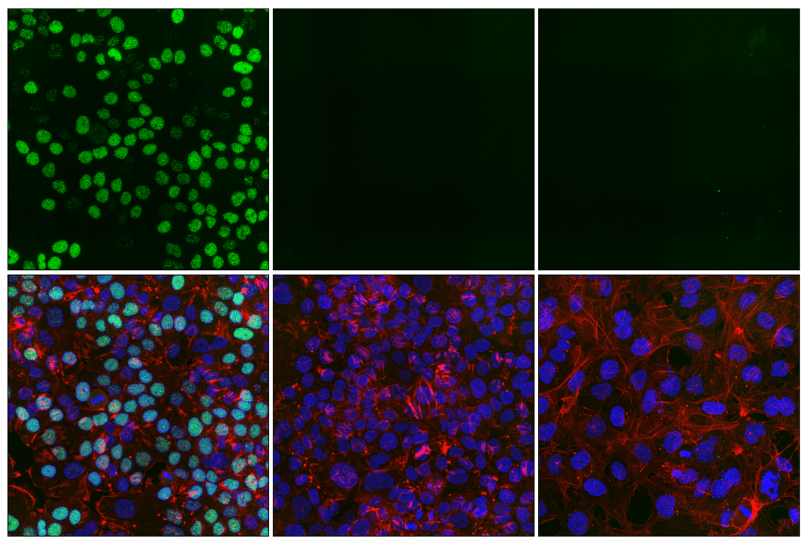 Immunofluorescence Image 1: Phospho-Rb (Thr821) (E6J1L) Rabbit Monoclonal Antibody