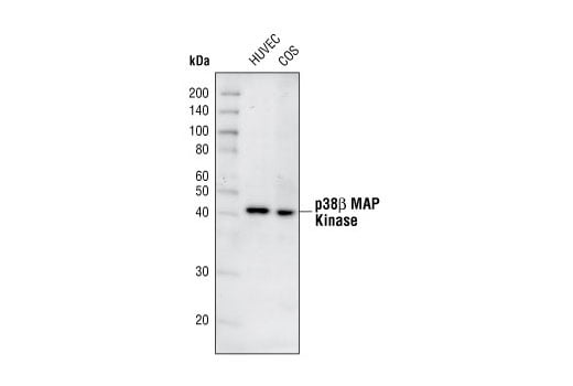 Western Blotting Image 2: p38 beta MAPK (C28C2) Rabbit Monoclonal Antibody