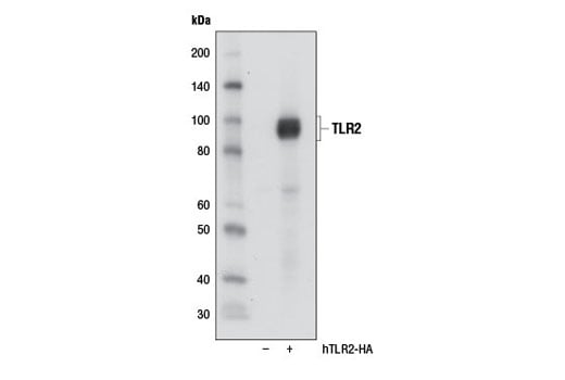 undefined Image 10: Toll-like Receptor Antibody Sampler Kit II