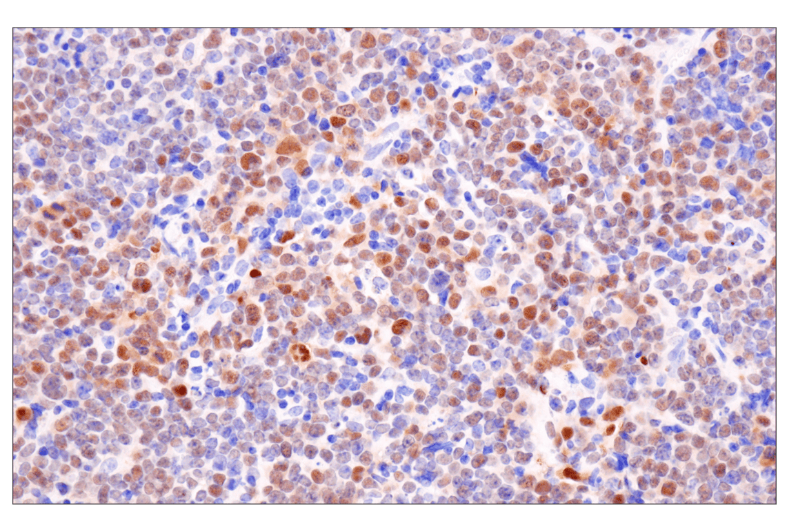 Immunohistochemistry Image 1: p19 ARF (F6F7N) Rabbit Monoclonal Antibody