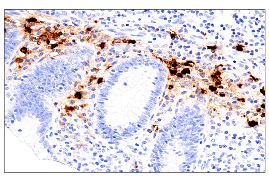 Immunohistochemistry Image 11: Eosinophil cationic protein (E6U5M) Rabbit Monoclonal Antibody