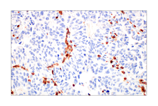 Immunohistochemistry Image 1: CD2 (D6V9F) Rabbit Monoclonal Antibody (BSA and Azide Free)