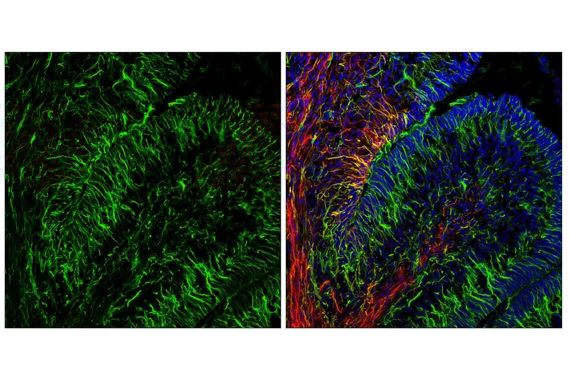 Immunofluorescence Image 1: Nestin (E5C7I) Rabbit Monoclonal Antibody (BSA and Azide Free)