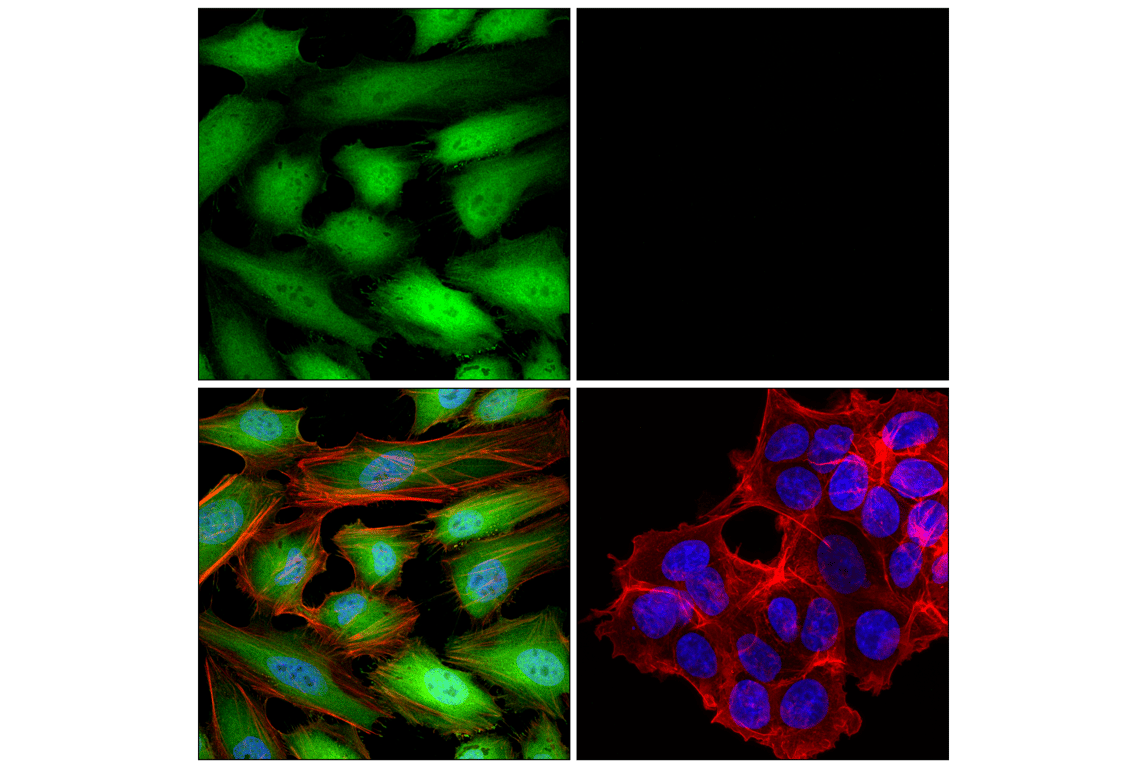 Immunofluorescence Image 1: p16 INK4A (F9T1L) Rabbit Monoclonal Antibody