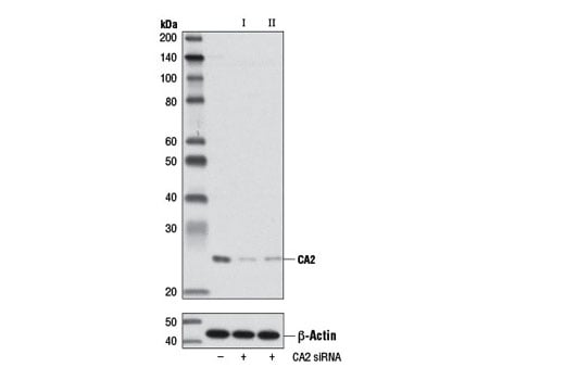 undefined Image 1: SignalSilence<sup>®</sup> CA2 siRNA I