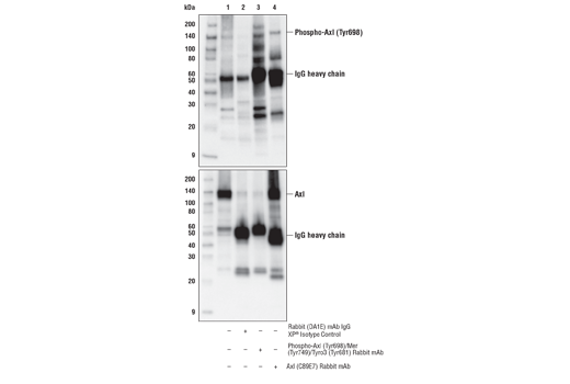 Immunoprecipitation Image 1: Phospho-Axl (Tyr698)/Mer (Tyr749)/Tyro3 (Tyr681) (D6M4W) Rabbit Monoclonal Antibody