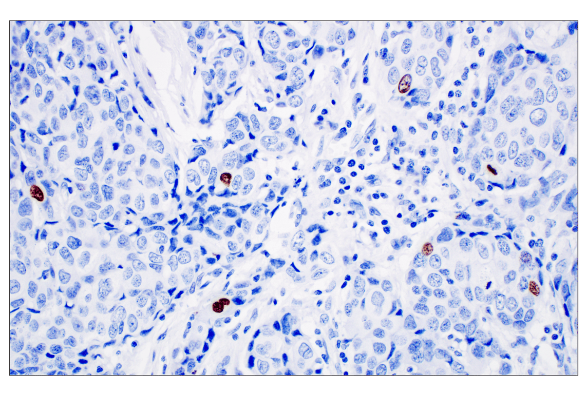 Immunohistochemistry Image 4: Phospho-Histone H3 (Ser10) (D7N8E) Rabbit Monoclonal Antibody (BSA and Azide Free)