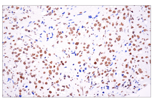 Immunohistochemistry Image 8: ATRX (E5X7O) Rabbit Monoclonal Antibody