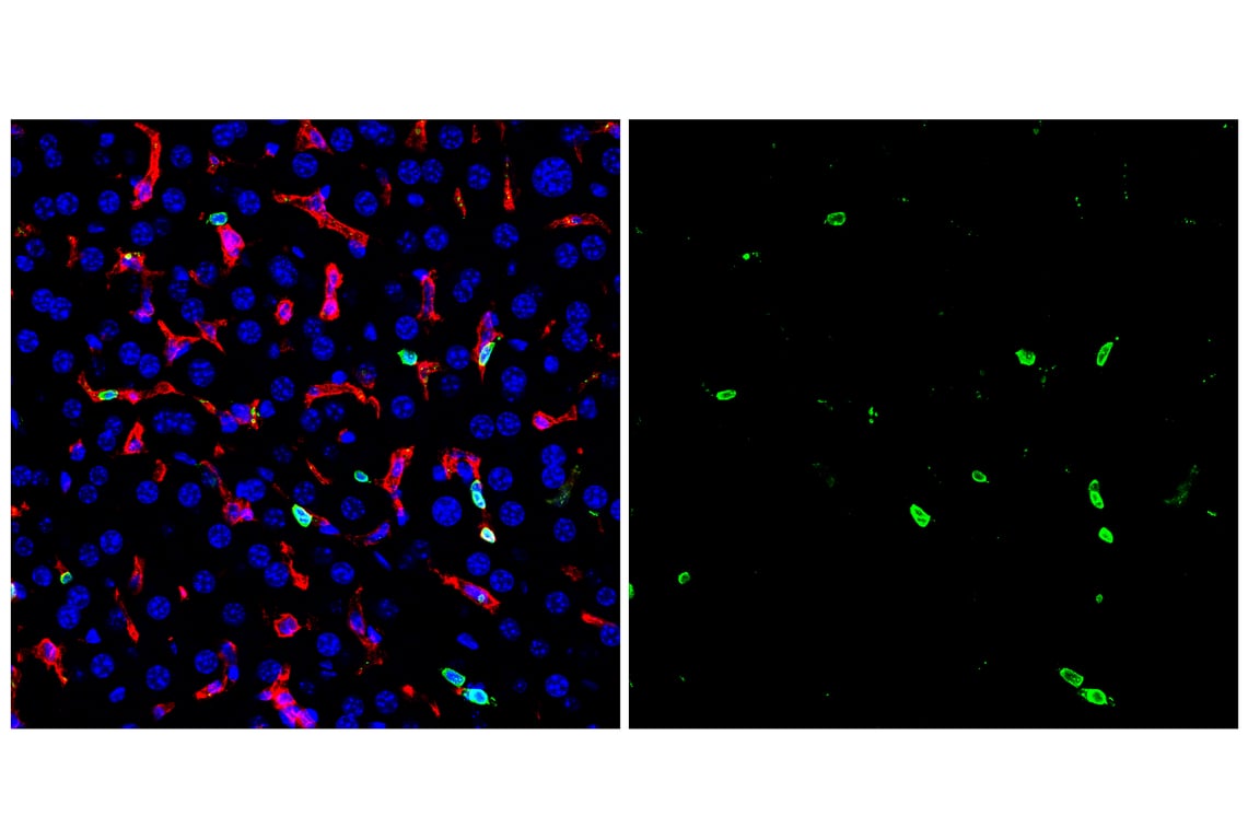 Immunofluorescence Image 1: CD20 (E3N7O) Rabbit Monoclonal Antibody