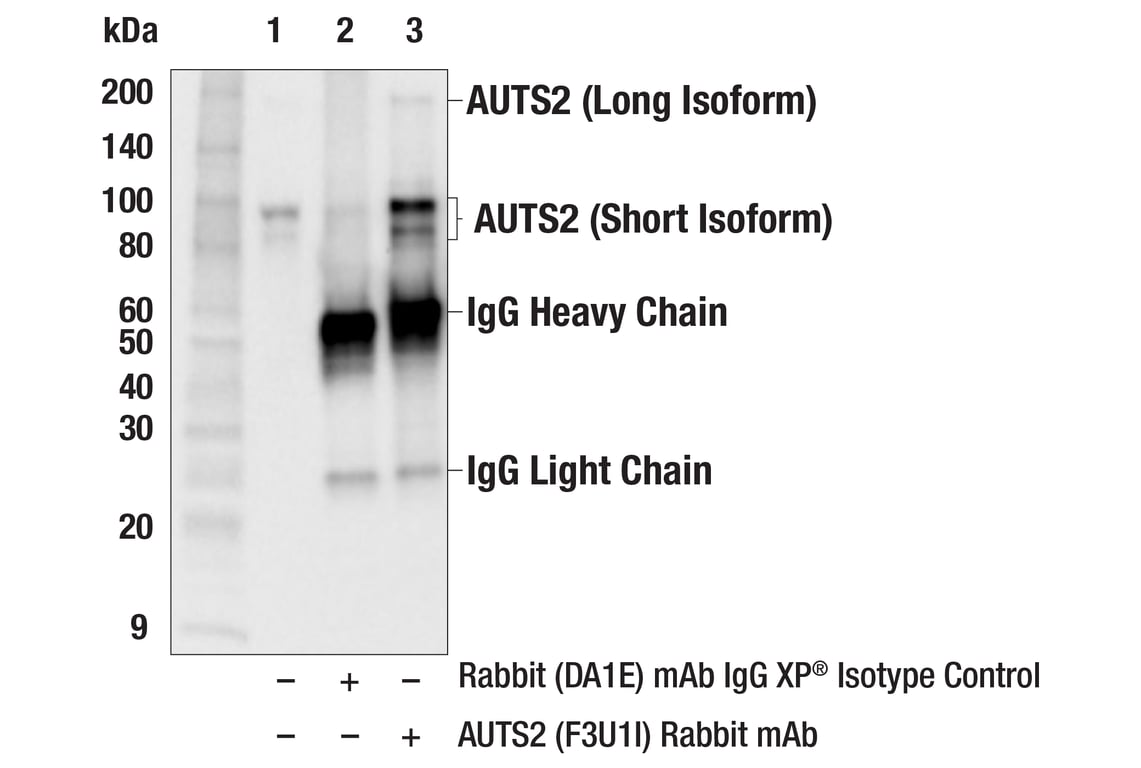 Immunoprecipitation Image 1: AUTS2 (F3U1I) Rabbit Monoclonal Antibody