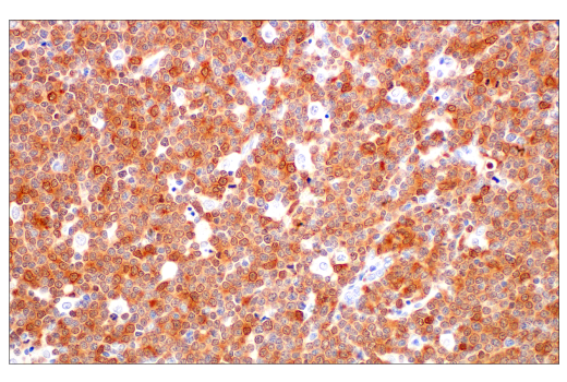 Immunohistochemistry Image 6: p16 INK4A (BC42) Mouse Monoclonal Antibody