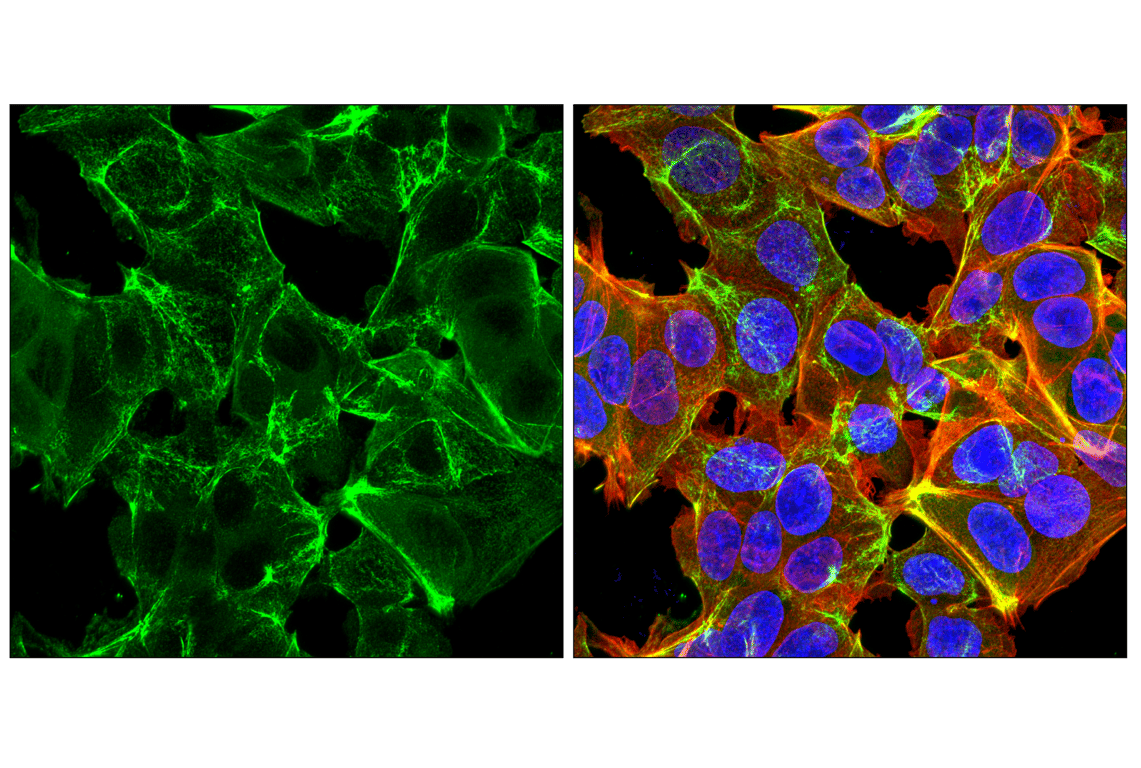 Immunofluorescence Image 2: Myosin IIc (D4A7) Rabbit Monoclonal Antibody