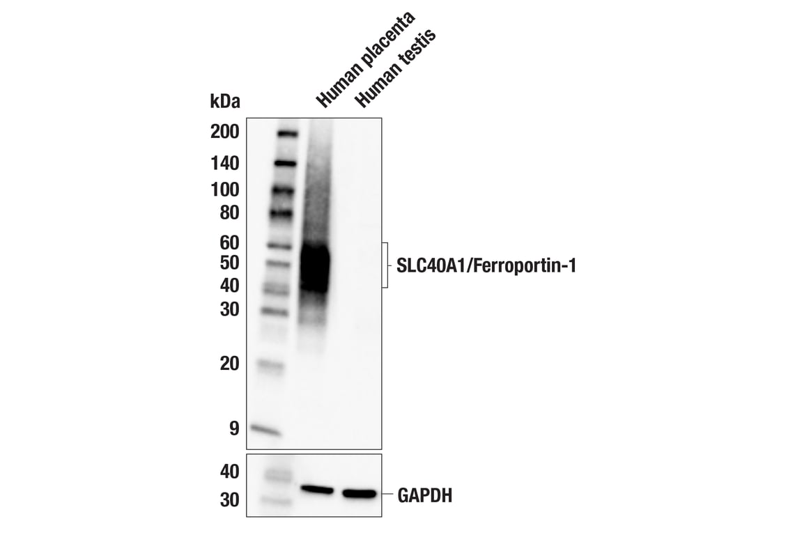 Western Blotting Image 2: SLC40A1/Ferroportin-1 (F4A2M) Rabbit Monoclonal Antibody