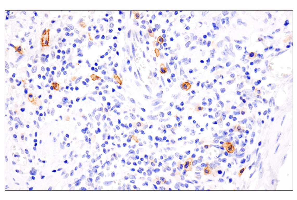 Immunohistochemistry Image 4: TNFRSF17/BCMA (E6D7B) Rabbit Monoclonal Antibody