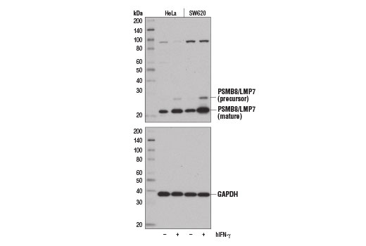 Western Blotting Image 2: PSMB8/LMP7 (D1K7X) Rabbit Monoclonal Antibody