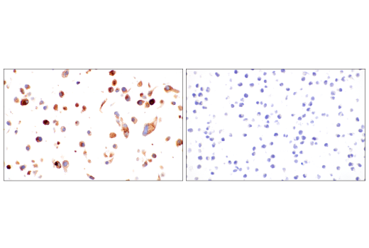 Immunohistochemistry Image 8: TIMP1 (D10E6) Rabbit Monoclonal Antibody