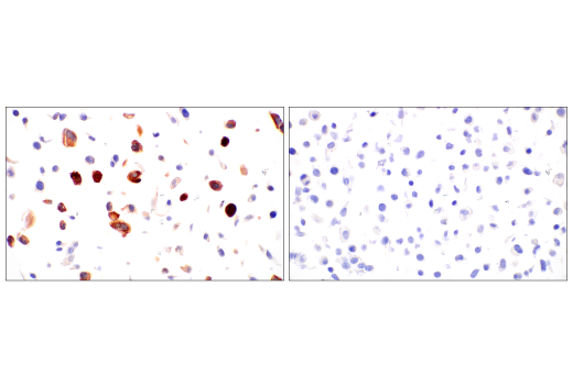 Immunohistochemistry Image 5: SARS-CoV-2 Nucleocapsid Protein (E9L7H) Rabbit Monoclonal Antibody