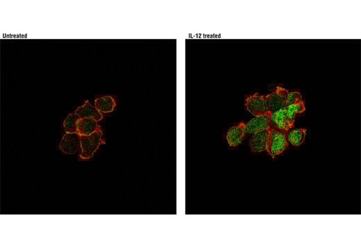 Immunofluorescence Image 1: Phospho-Stat4 (Tyr693) (D2E4) Rabbit Monoclonal Antibody (BSA and Azide Free)