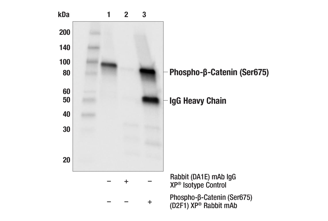 undefined Image 32: beta-Catenin Antibody Sampler Kit