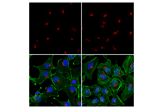 Immunofluorescence Image 1: GM130 (D6B1) XP<sup>®</sup> Rabbit mAb (Alexa Fluor<sup>®</sup> 555 Conjugate)