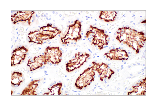 Immunohistochemistry Image 6: ACE2 (E9G3S) Mouse mAb