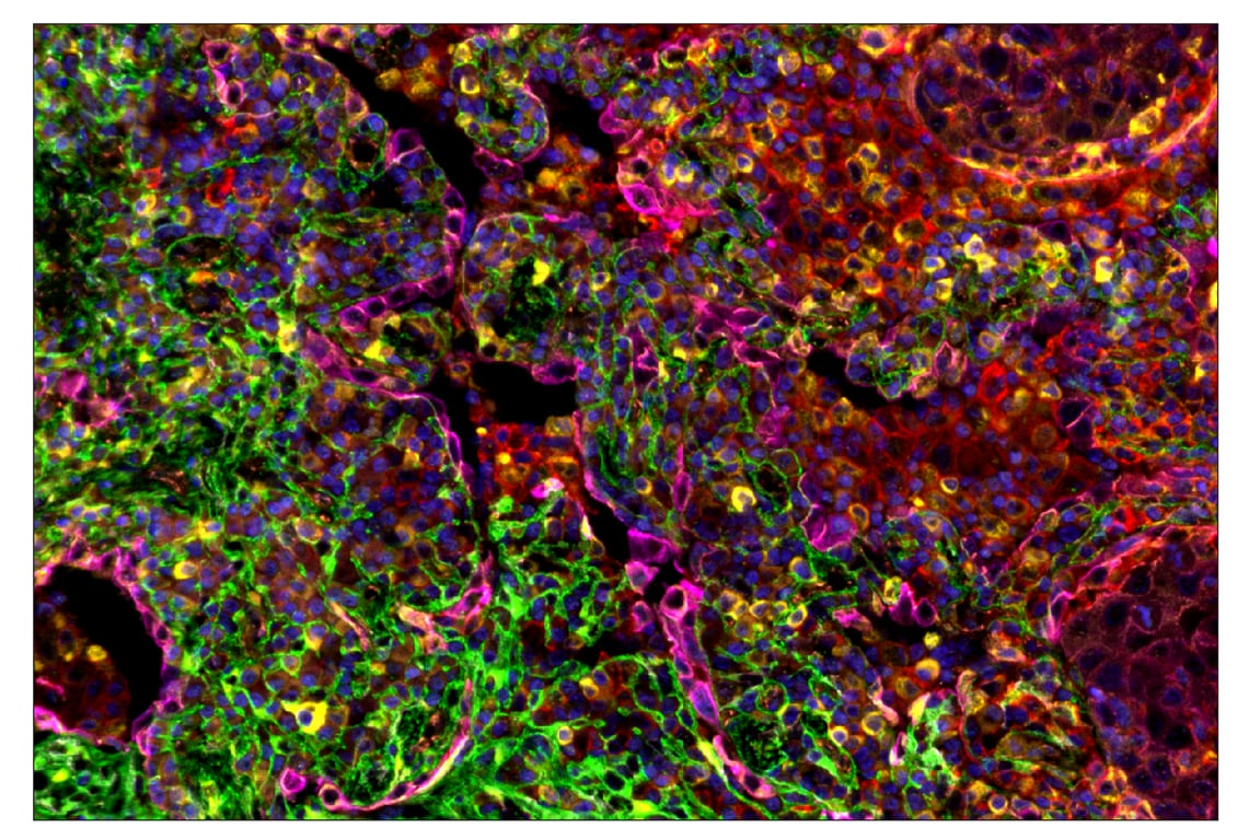 Immunohistochemistry Image 6: CD40 (D8W3N) & CO-0115-750 SignalStar<sup>™</sup> Oligo-Antibody Pair