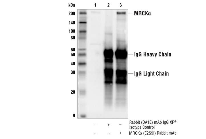 Immunoprecipitation Image 1: MRCK alpha (E2S5I) Rabbit Monoclonal Antibody