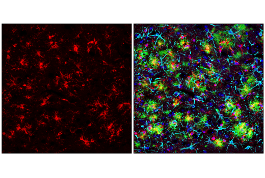 Immunofluorescence Image 1: SHIP1 (E8M5D) Rabbit Monoclonal Antibody