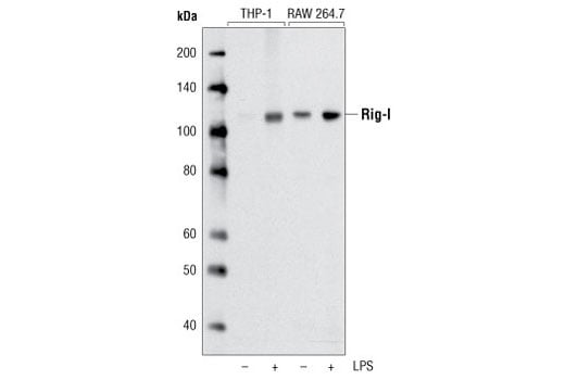 Western Blotting Image 2: Rig-I (D33H10) Rabbit Monoclonal Antibody