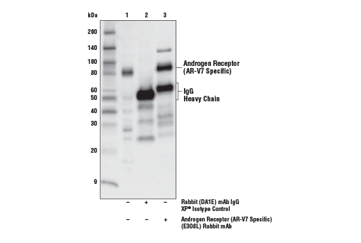 Immunoprecipitation Image 1: Androgen Receptor (AR-V7 Specific) (E3O8L) Rabbit Monoclonal Antibody