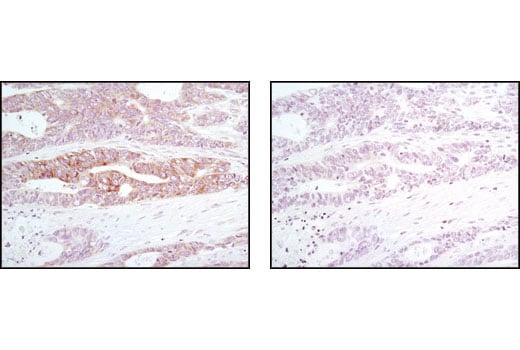 Immunohistochemistry Image 1: Phospho-eIF2 alpha (Ser51) (D9G8) Rabbit Monoclonal Antibody