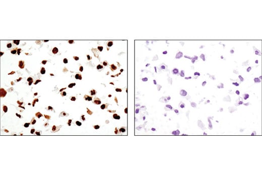 Immunohistochemistry Image 2: DNA-PKcs (3H6) Mouse Monoclonal Antibody